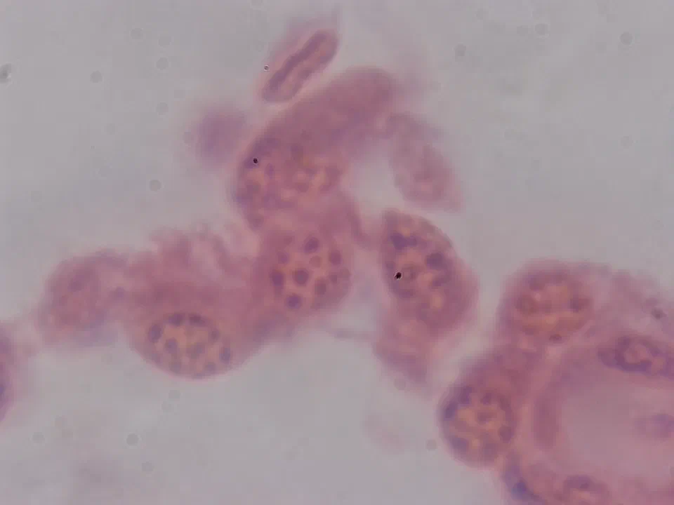 Testicule de lapin, objectif 100x