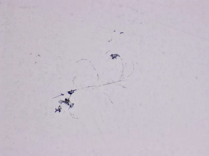 Des structures microscopiques sombres et filamenteuses sont dispersées aléatoirement sur un fond blanc, observées au microscope.