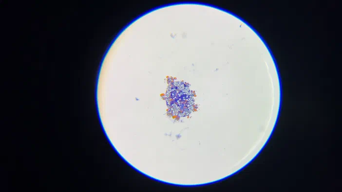 Champ microscopique montrant un organisme central coloré en bleu et orange