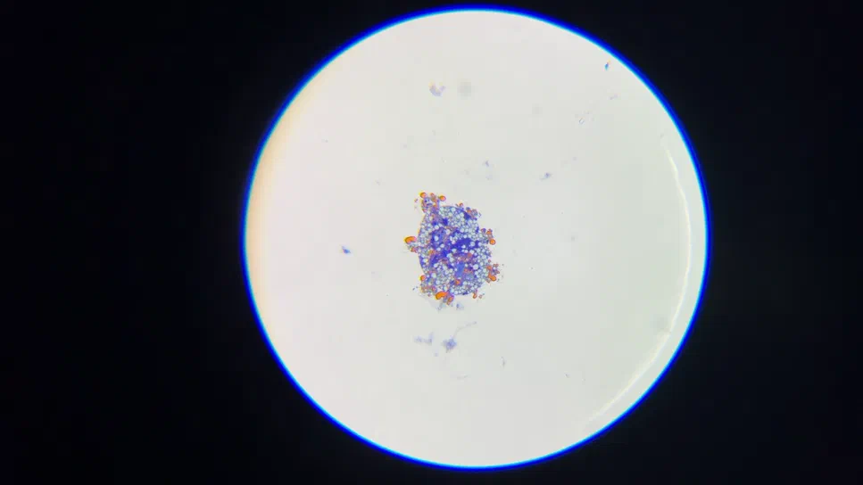 Coloration au bleu de méthylène Champ microscopique montrant un organisme central coloré en bleu et orange