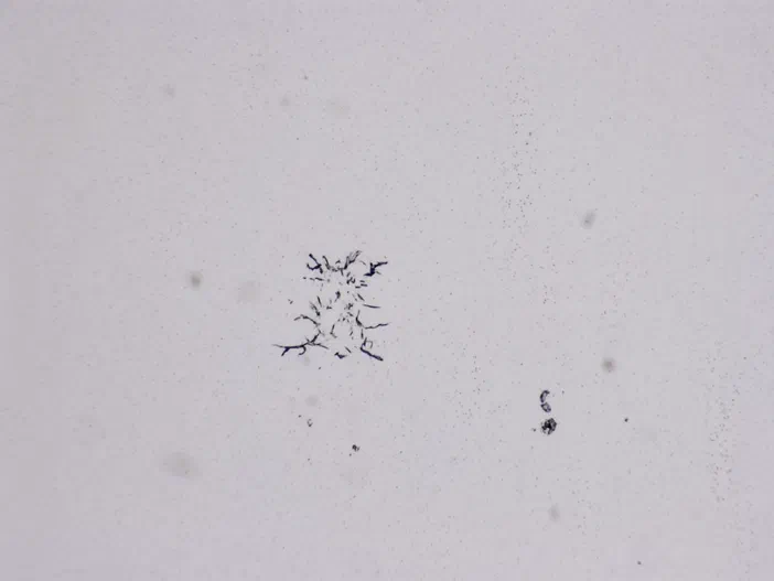Vue microscopique montrant des structures filamenteuses noires dispersées sur un fond blanc texturé et parsemé de particules fines.