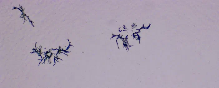 Des structures microscopiques filamenteuses et ramifiées apparaissent en noir sur un fond blanc.