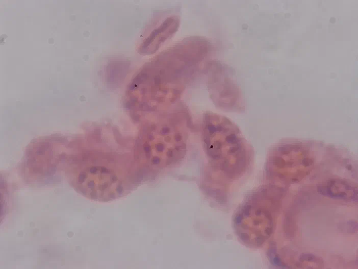 Vue microscopique d'un amas de cellules biologiques colorées en rose et violet sur fond gris clair.