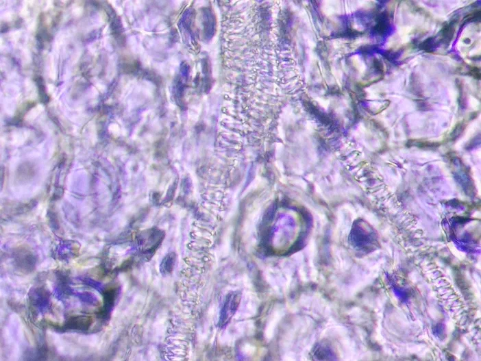 Vue microscopique d'une grassette commune montrant une structure hélicoïdale entourée de cellules.