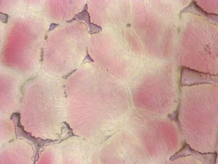 Vue microscopique des cellules de l'épiderme d'une anthère ou sac pollinique du Pyrus.