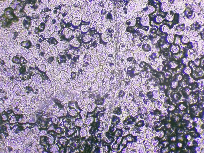 Vue microscopique de la grassette commune montrant une structure hélicoïdale à l'objectif 10x