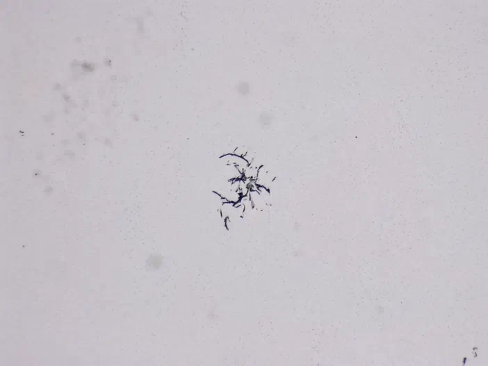 Vue microscopique de structures filamenteuses sombres sur fond clair.