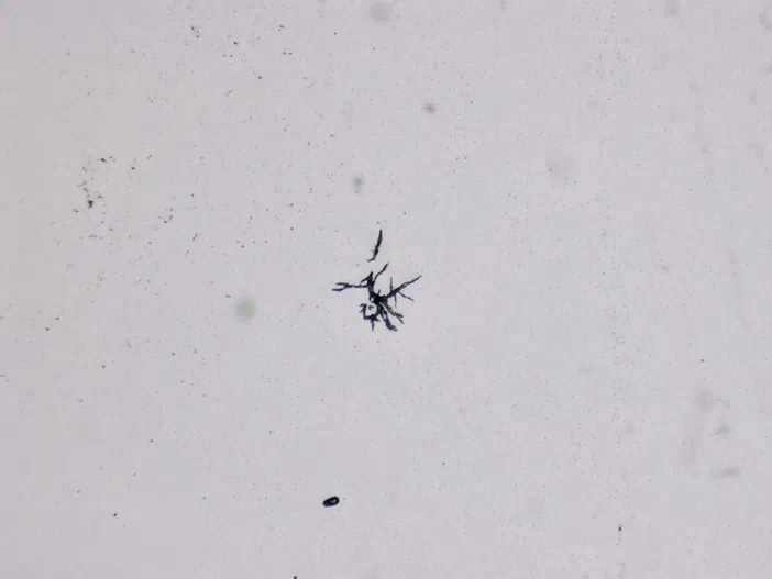 Vue microscopique de structures noires filamenteuses sur fond blanc granuleux