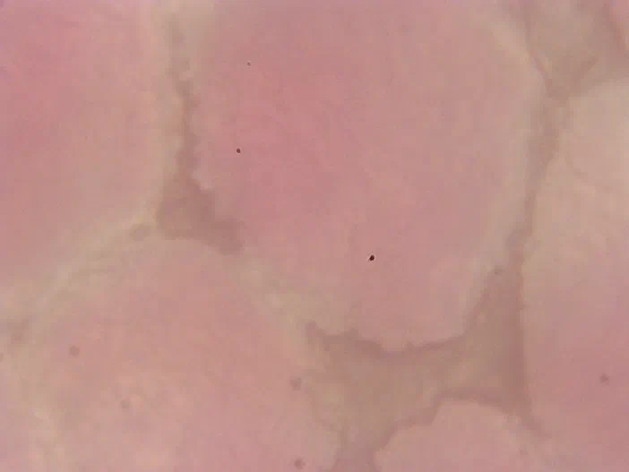Vue microscopique des cellules de l'épiderme d'une anthère ou sac pollinique du Pyrus.