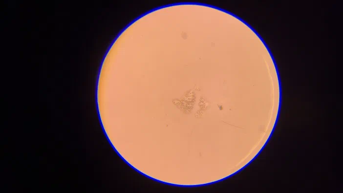 Vue microscopique d'une structure arborescente colorée en rose sur fond orange, observée avec un filtre éosine.