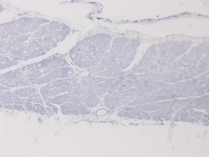 Vue microscopique à faible grossissement d'un échantillon de muscle squelettique de chien.