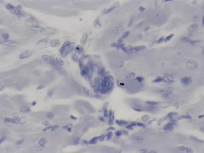 Vue microscopique à 40x d'un muscle squelettique de chien avec des fibres musculaires et noyaux visibles.