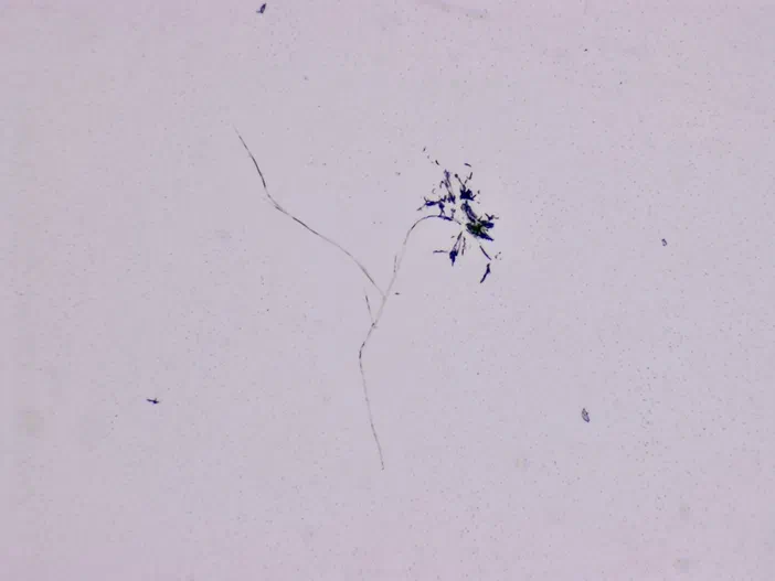 Vue microscopique d'une structure rappelant une fleur avec des filaments fins et un amas de pigments bleus sur fond clair.