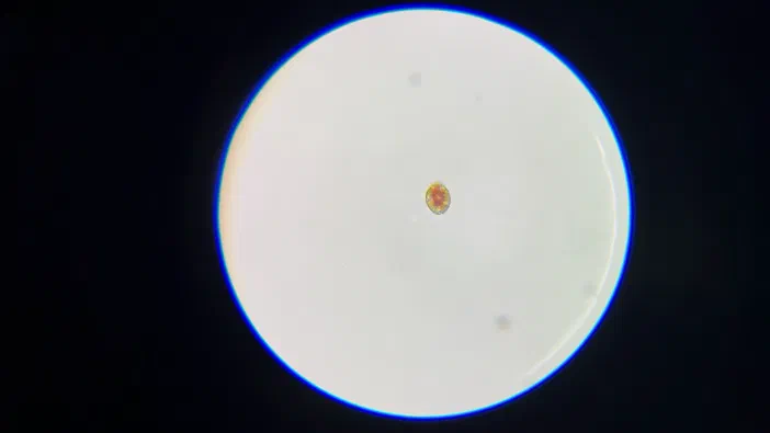 Vue microscopique d'un organisme non identifié flottant au centre de l'échantillon, entouré par une membrane visible et présentant des couleurs naturelles.