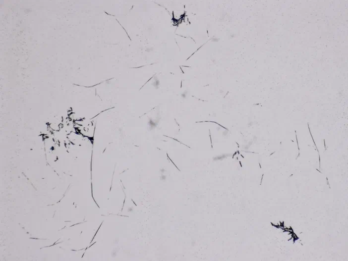 Vue microscopique de fines structures filamenteuses sombres dispersées sur un fond clair.