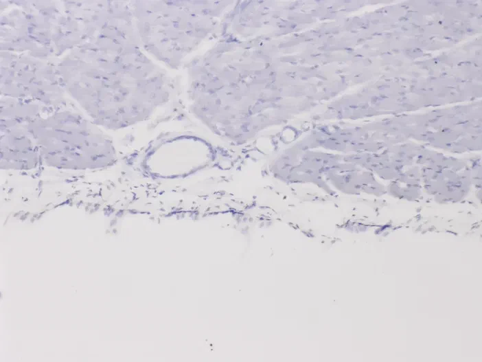 Vue microscopique à 10x du muscle squelettique de chien montrant les fibres musculaires striées et un vaisseau sanguin.