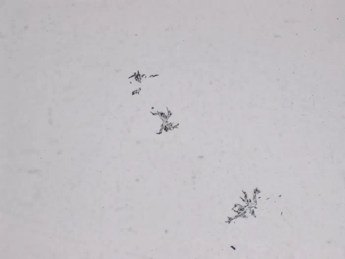 Vue microscopique de structures sombres et filamenteuses sur fond clair.