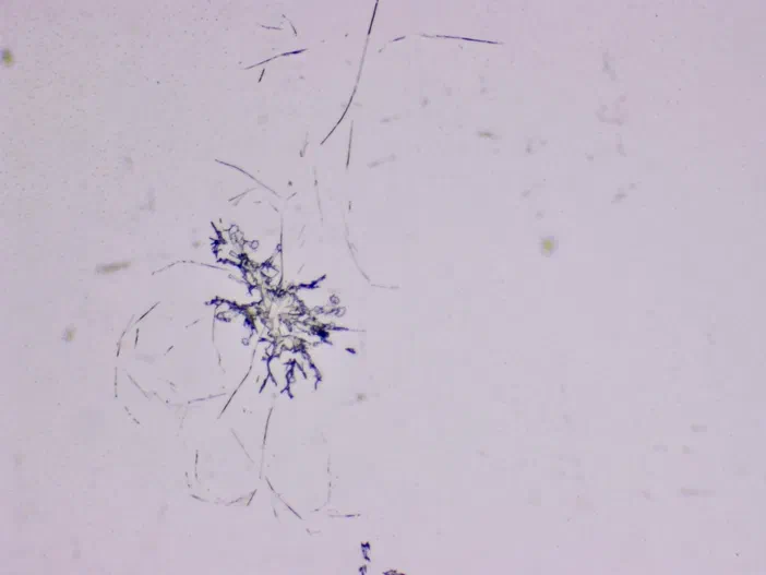 Vue microscopique de structures filamenteuses bleues sur fond clair.